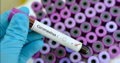 Армения получит тесты коронавируса